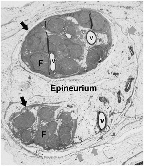 epineurium